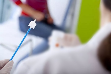 Fremskridt inden for screening af livmoderhalskræft: Rollen af selvindsamling HPV-tests