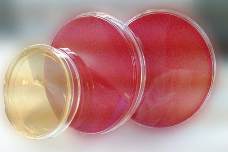 Salmonella Shigella Agar (SS): Det essentielle medium til patogenisolering