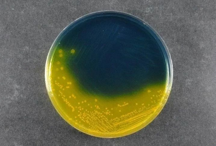 At sikre fødevaresikkerhed: Babios Salmonella Shigella Agar (SS) understøtter globale patogendetekteringsstandarder