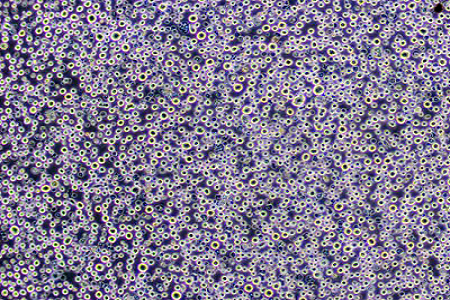 Kartoffel dextrose agar (USP) - pålideligt medium til form og gærdetektion