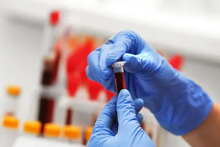 BABIO lancerer Fluorescence Bovin Graviditets-hurtigtest