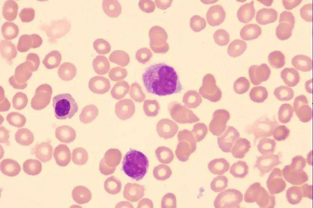 Griseparatyfusvaccinemedium til veterinærvaccineproduktion